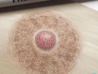 Création d&rsquo;aréoles mammaires